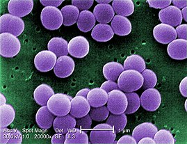270px-Staphylococcus_aureus_VISA_2.jpg