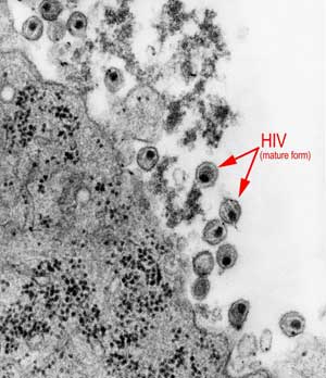 HIV-mature-forms-300_tcm18-86436.jpg